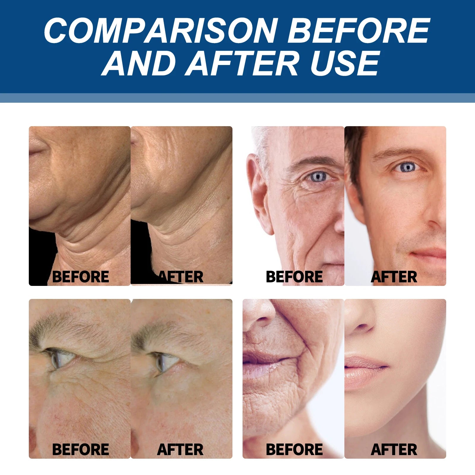 East Moon Men's Facial Fade Acne Marcas Limpe Fechar Cravos Suave Hidratante Hidratar Anti-rugas Creme de Colágeno