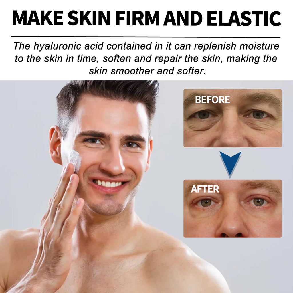 East Moon Men's Facial Fade Acne Marcas Limpe Fechar Cravos Suave Hidratante Hidratar Anti-rugas Creme de Colágeno