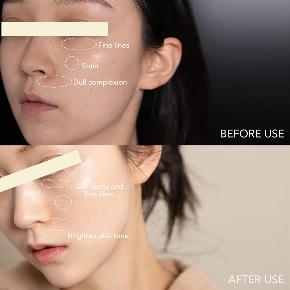 AILKE Corretor de manchas escuras, hidratação branqueadora, creme facial com spf35 + iluminação, tom de pele coreano, anti-queimaduras solares, cuidados com a pele do rosto
