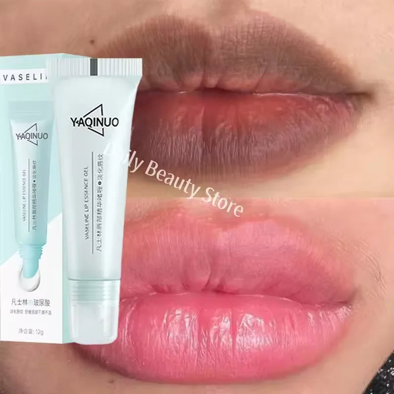 Remover bálsamo labial escuro, clareamento rápido, esfoliante labial rosa, linha labial, hidratante de pele morta, produtos de cuidados coreanos, beleza e saúde