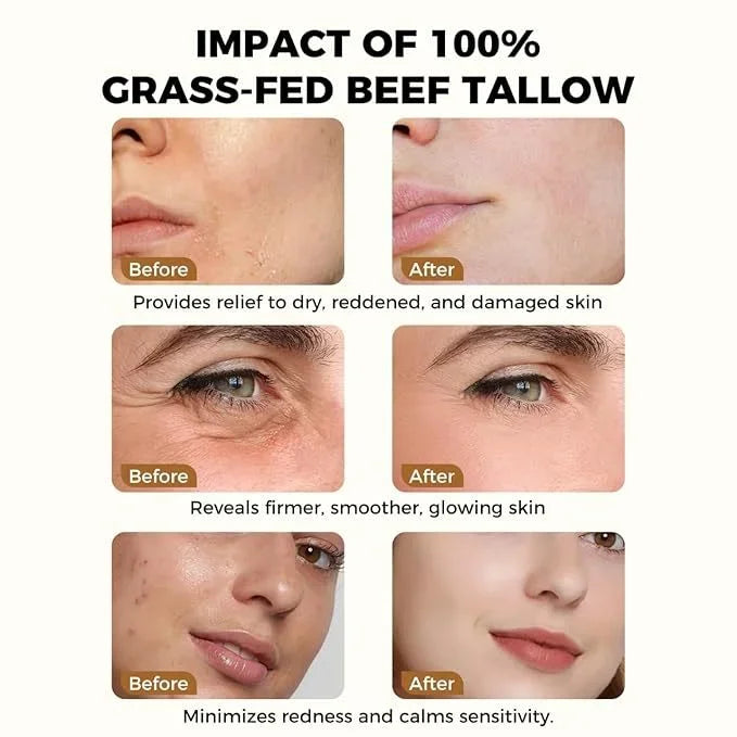 Creme Hidratante de Mel de Manfe Tallow - Hidratação Profunda Nutritivo Iluminador Reparação de Vermelhidão Minimizador de Poros para Mulheres Sensíveis Dr