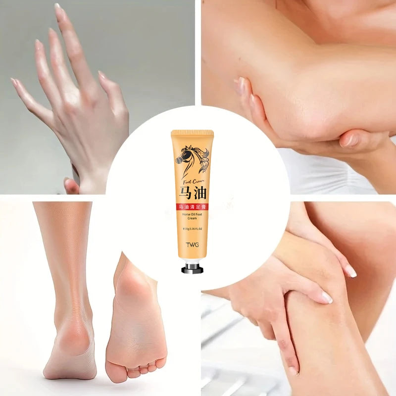 Ma You Qing Creme para pés, Creme hidratante para pés, adequado para pele seca, adequado para cuidados com as mãos e pés para mãos e pés secos