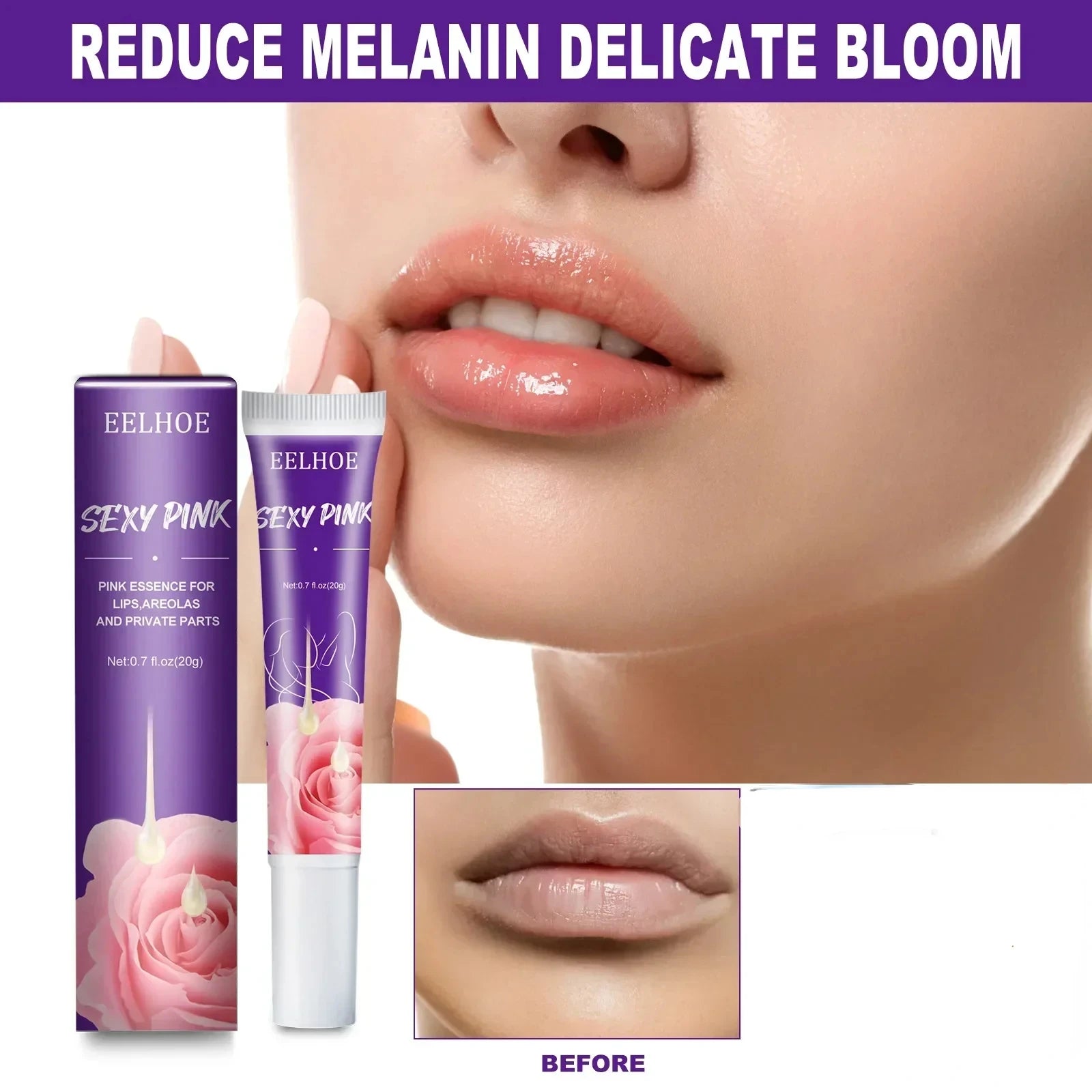 Creme de clareamento para peças íntimas, Soro das axilas, Bunda, Joelho, Interior, Coxa, Peças de clareamento íntimo, Remover melanina