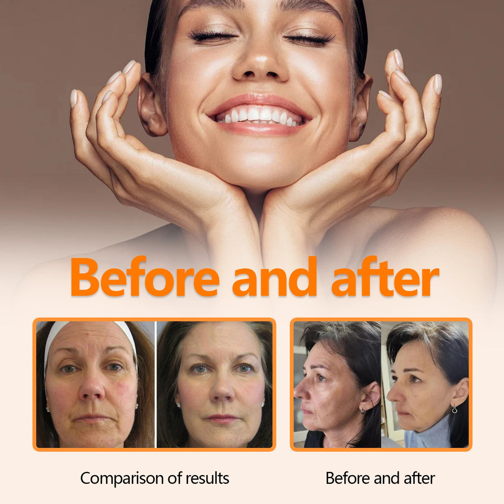O soro facial com vitamina C reduz linhas finas e ilumina a pele naturalmente sem adição de retinol, óleo de jojoba, produtos de cuidados faciais