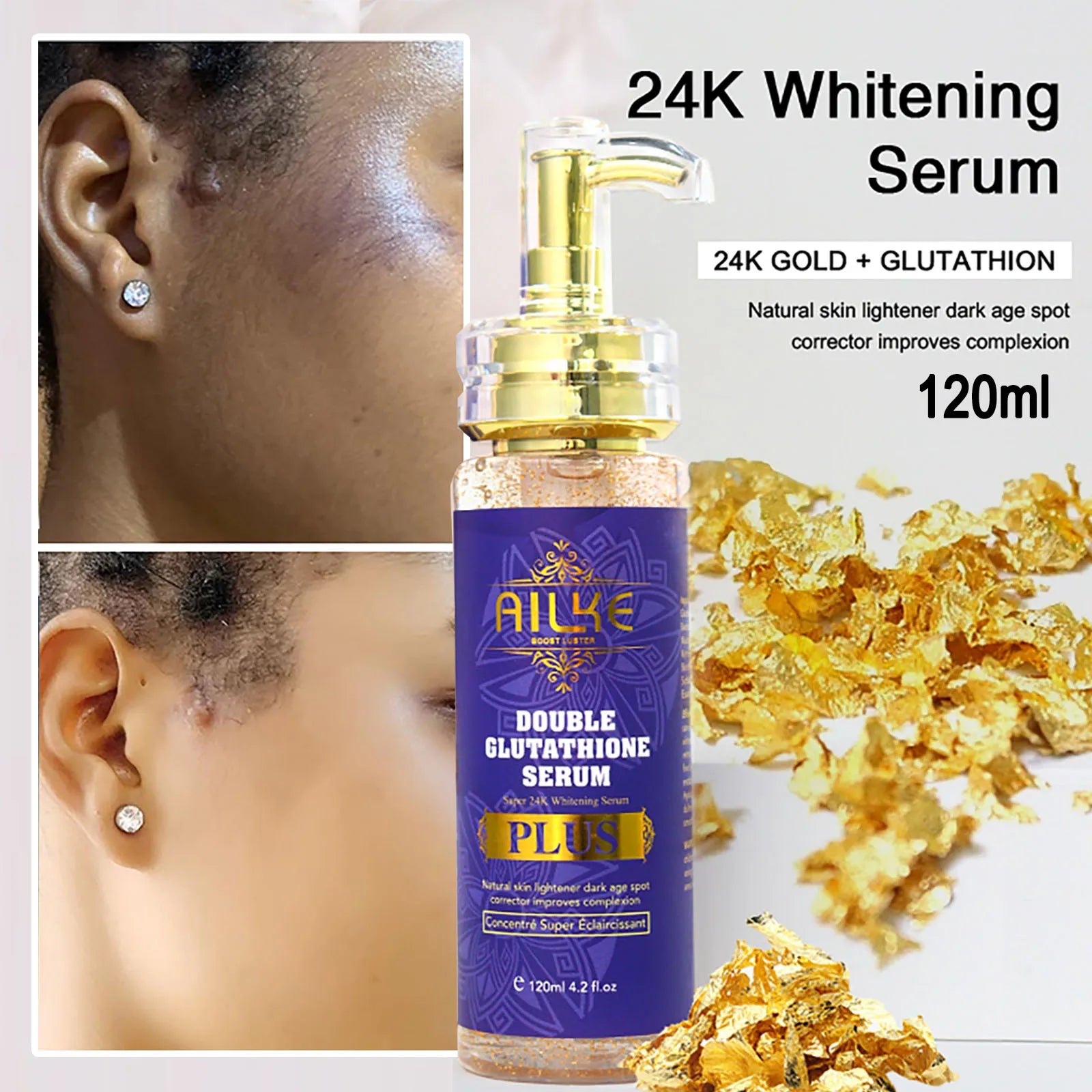 Soro anti-manchas pretas AILKE, essência iluminadora para uma tez uniforme e radiante, reduz sardas, pigmentação, 120 ml