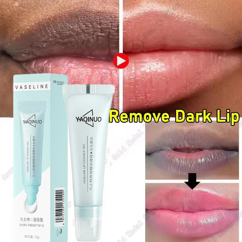 Remover bálsamo labial escuro, clareamento rápido, esfoliante labial rosa, linha labial, hidratante de pele morta, produtos de cuidados coreanos, beleza e saúde