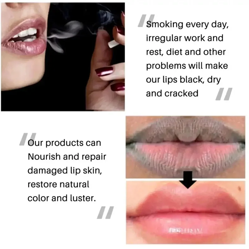 Remover bálsamo labial escuro, clareamento rápido, esfoliante labial rosa, linha labial, hidratante de pele morta, produtos de cuidados coreanos, beleza e saúde