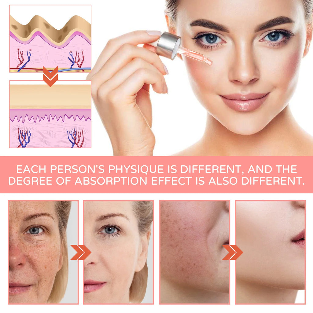 Sérum Facial 5 em 1 para Redução de Linhas Finas, Firmador, Redutor de Manchas e Pigmentação, Hidratante e Firmador da Pele.
