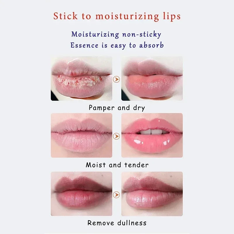 Remover bálsamo labial escuro, clareamento rápido, esfoliante labial rosa, linha labial, hidratante de pele morta, produtos de cuidados coreanos, beleza e saúde
