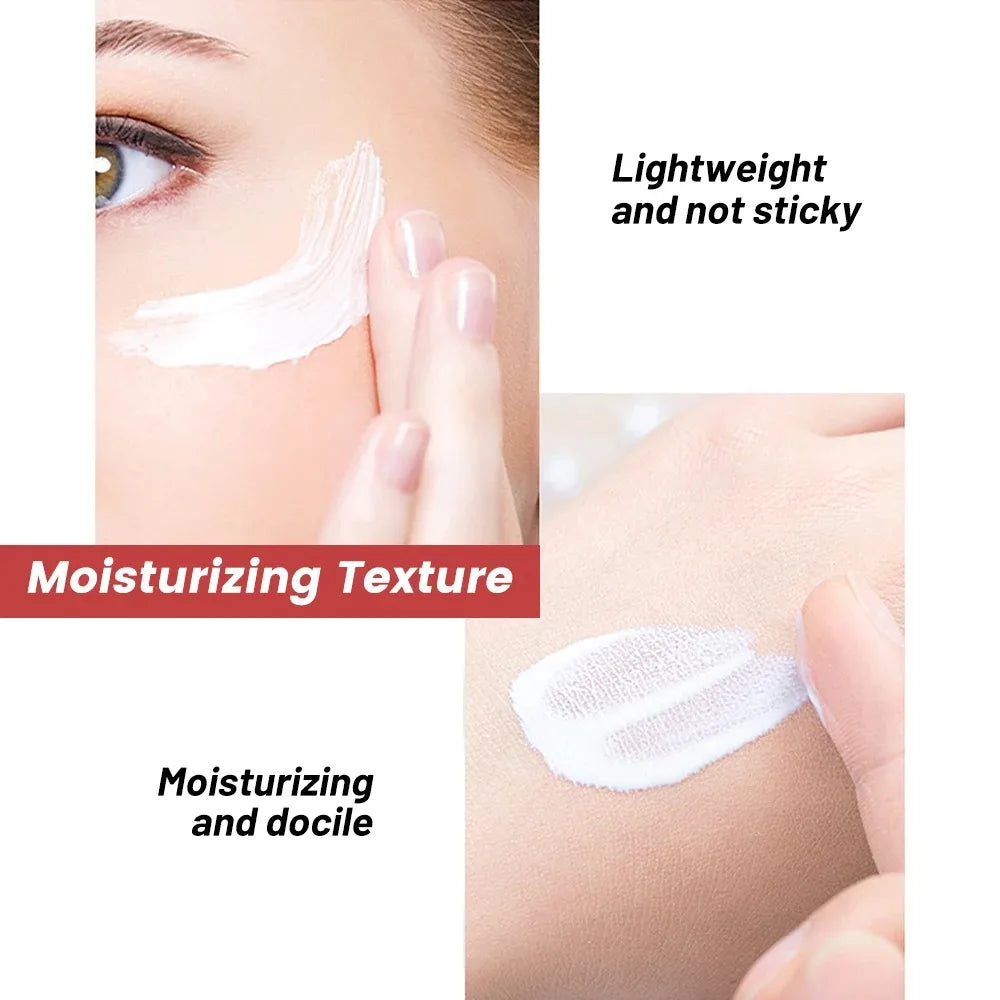 Poderoso creme de sardas para clarear o rosto, elimina manchas escuras do rosto, melasma, melanina, pigmentação, hidratar, creme de cuidados com a pele