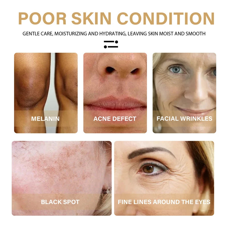 Cúrcuma rosto soro encolher poros essência reparação melanina iluminar hidratante nutrir cur-alumin óleo desbotar mancha escura cuidados com a pele
