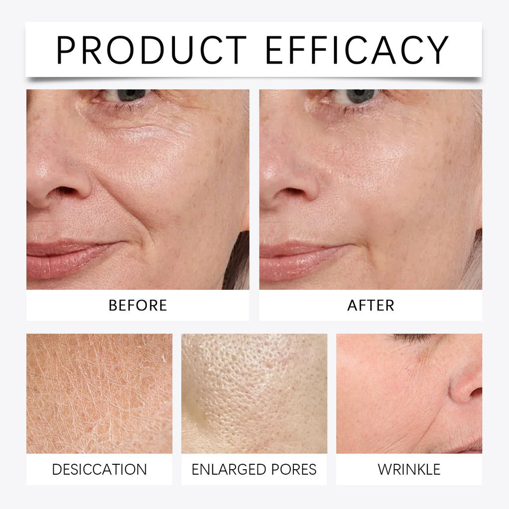 Conjunto de Sérum Facial Firmador com Rolo de Microagulhas, Essência Facial Anti-Envelhecimento, Hidratante, Suavizante e Embelezadora da Pele