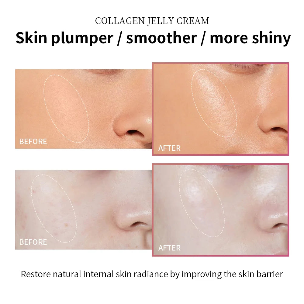 Creme facial de colágeno antienvelhecimento, 100ml, niacinamida, gel hidratante para apertar, calmar a firmeza, cuidados com a pele