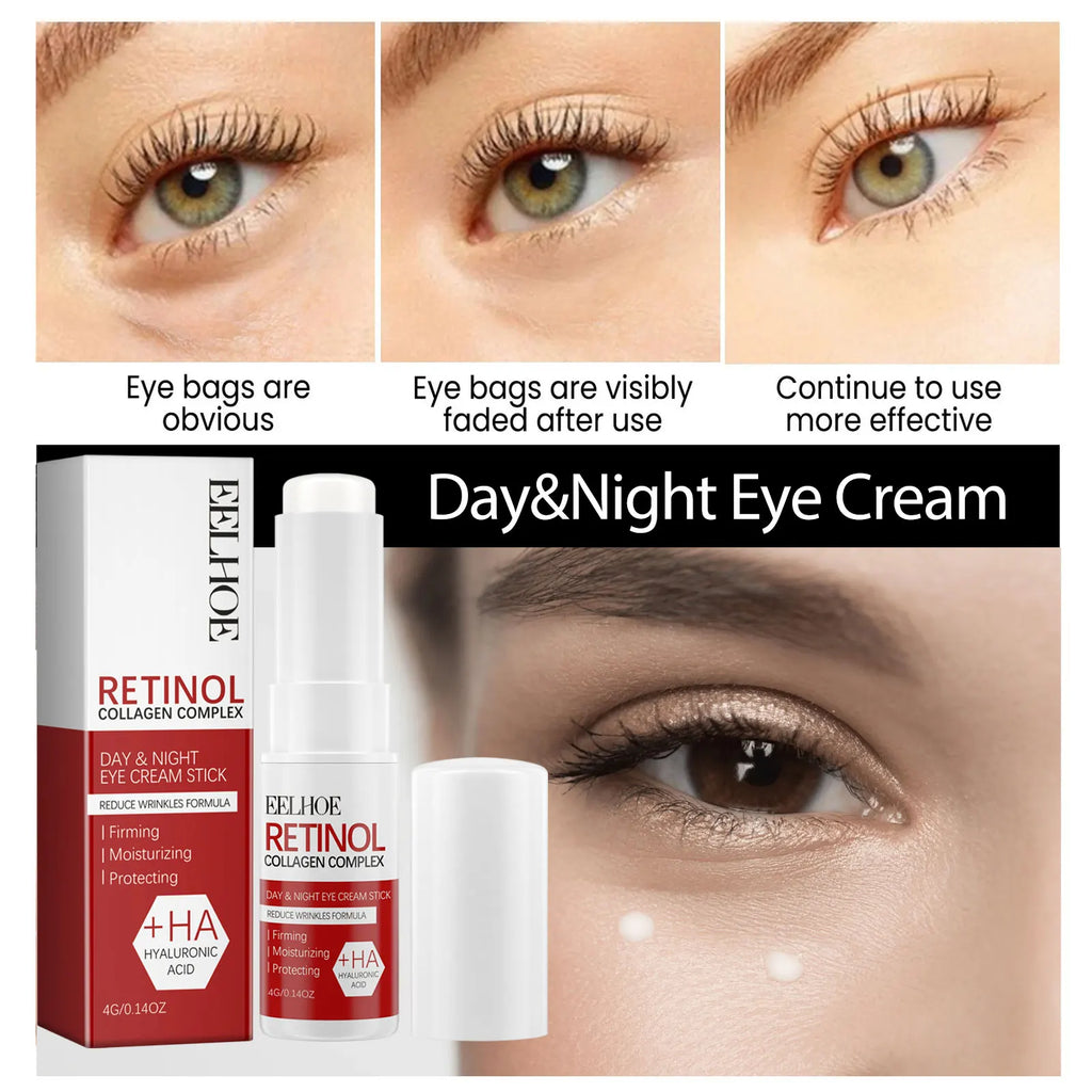 Eelhoe retinol olho vara 4g sob tratamento ocular círculo escuro redução de inchaço anti envelhecimento rolo linhas finas hidratante