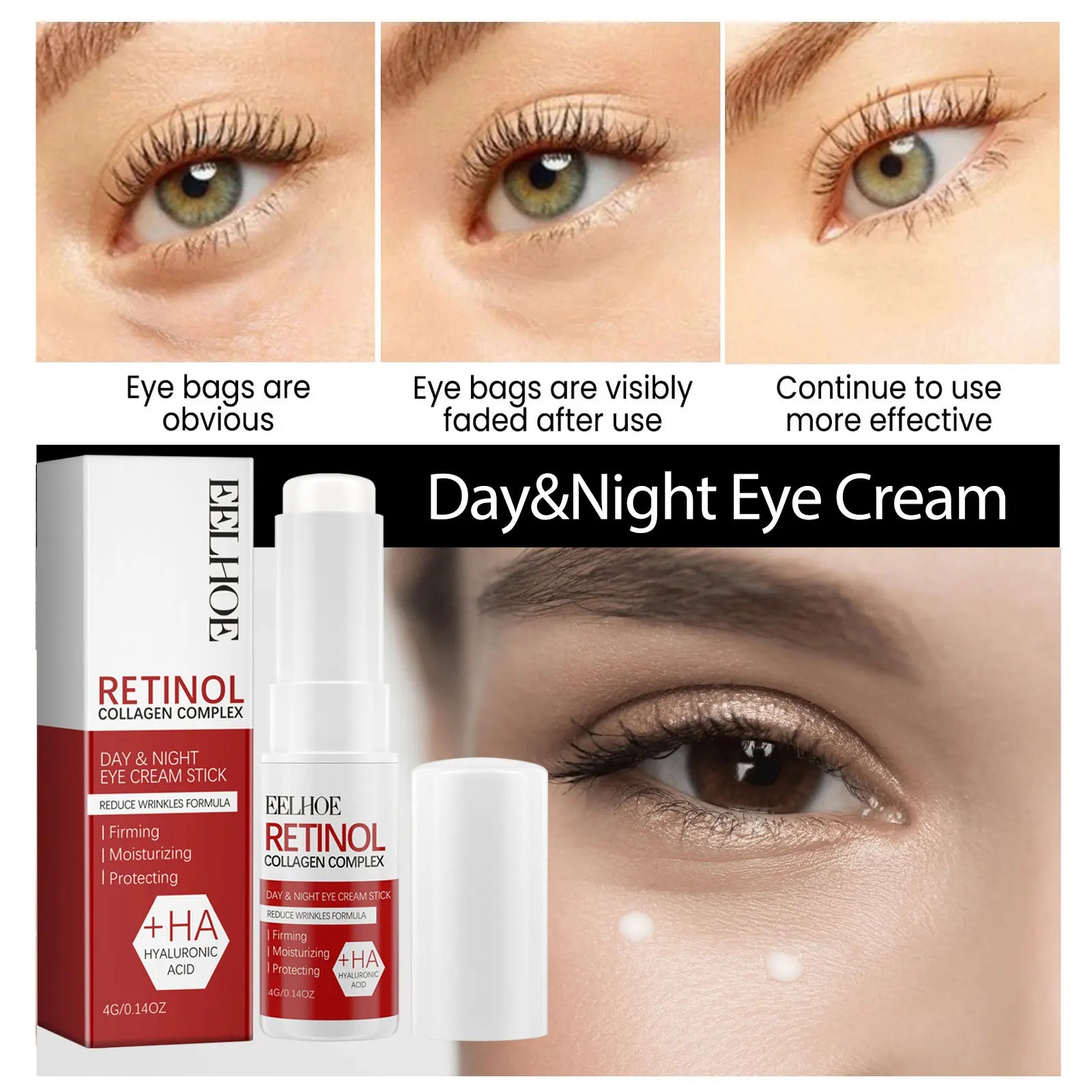 Eelhoe retinol olho vara 4g sob tratamento ocular círculo escuro redução de inchaço anti envelhecimento rolo linhas finas hidratante