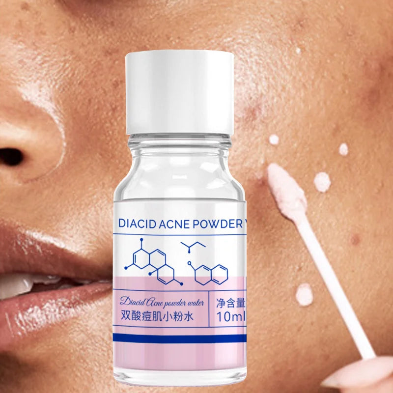 Essência concentrada de acne com ácido salicílico rosa de 10ml - contendo ácido salicílico, ácido lactose, calamina, ácido duplo, cuidado duplo, s