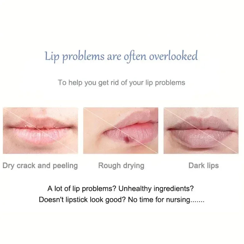 Remover bálsamo labial escuro, clareamento rápido, esfoliante labial rosa, linha labial, hidratante de pele morta, produtos de cuidados coreanos, beleza e saúde