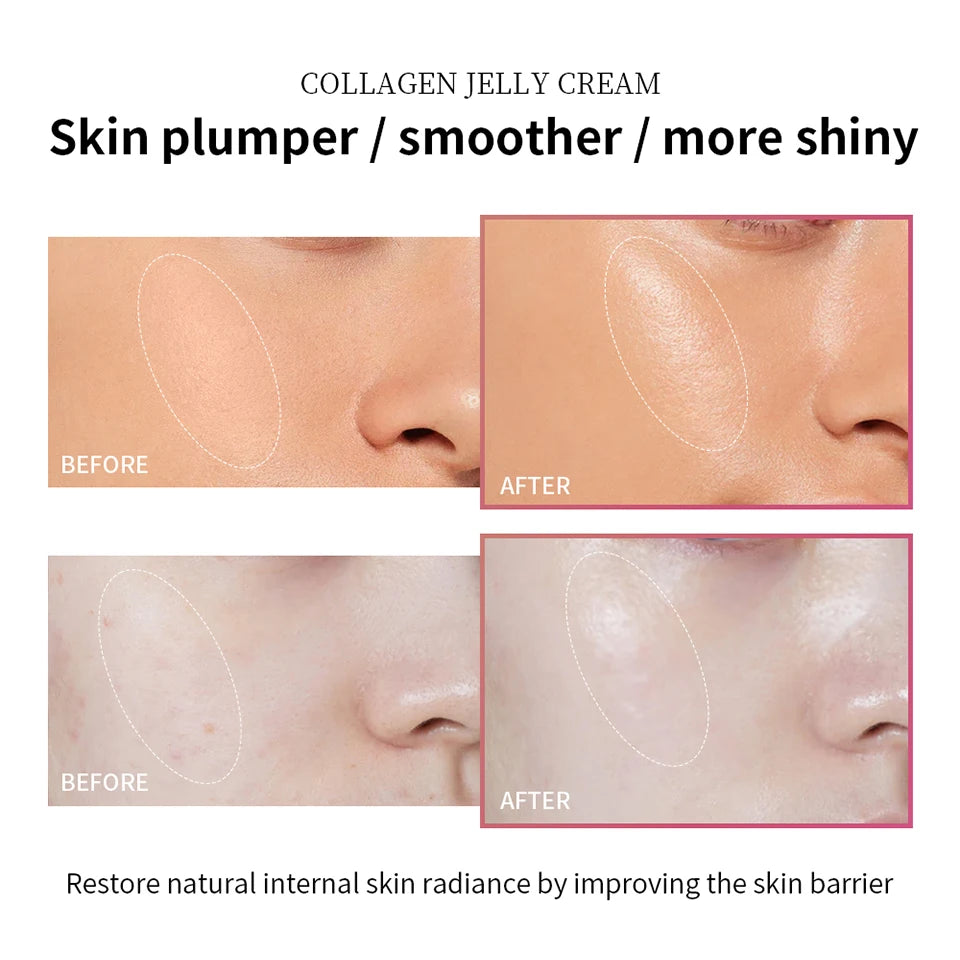 Creme facial de colágeno antienvelhecimento, 100ml, niacinamida, gel hidratante para apertar, calmar a firmeza, cuidados com a pele