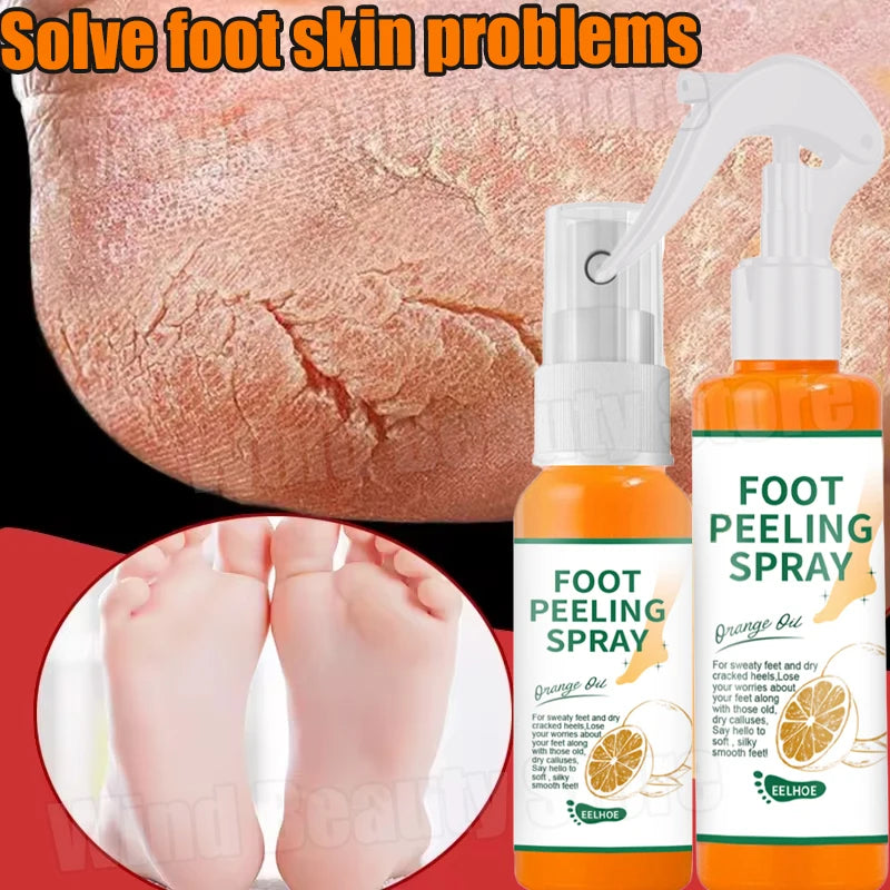 Creme anti-rachadura para pés, spray de ervas para rachaduras no calcanhar, produtos de reparo, esfoliação, remoção de pele morta, suavização, hidratação, cuidados suaves