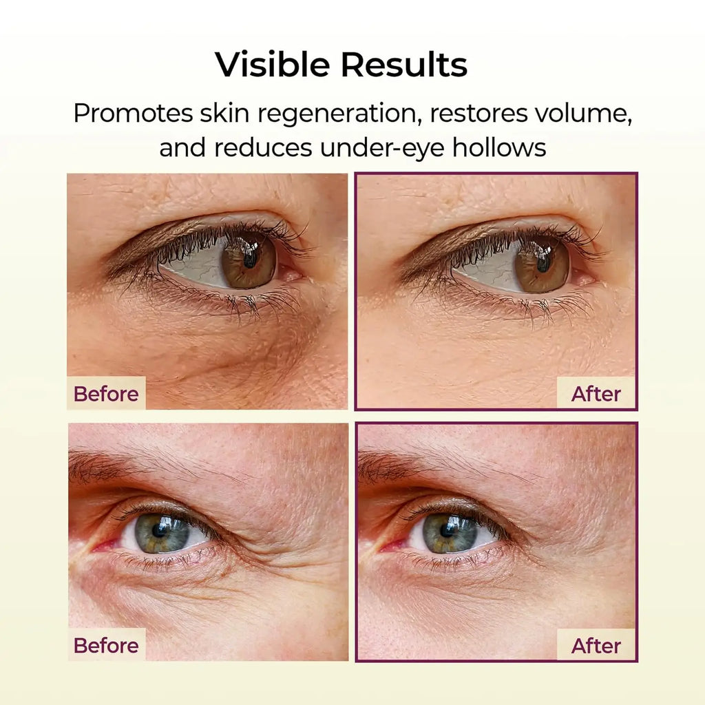 Bálsamo Multifuncional de Cálcio 9g Tudo em Um para Rugas, Volume e Colágeno - Tratamento Facial e Ocular