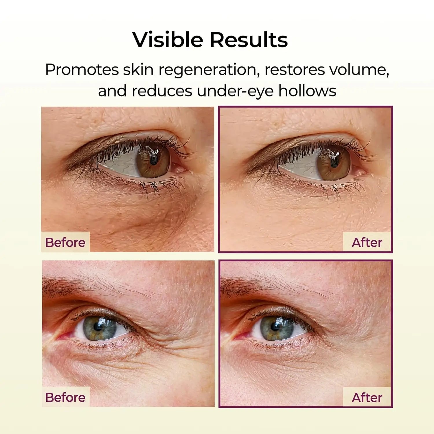 Bálsamo Multifuncional de Cálcio 9g Tudo em Um para Rugas, Volume e Colágeno - Tratamento Facial e Ocular