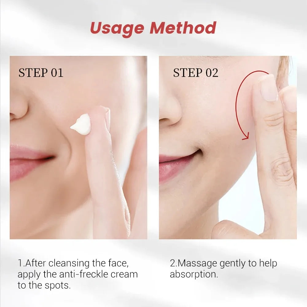 Poderoso creme de sardas para clarear o rosto, elimina manchas escuras do rosto, melasma, melanina, pigmentação, hidratar, creme de cuidados com a pele