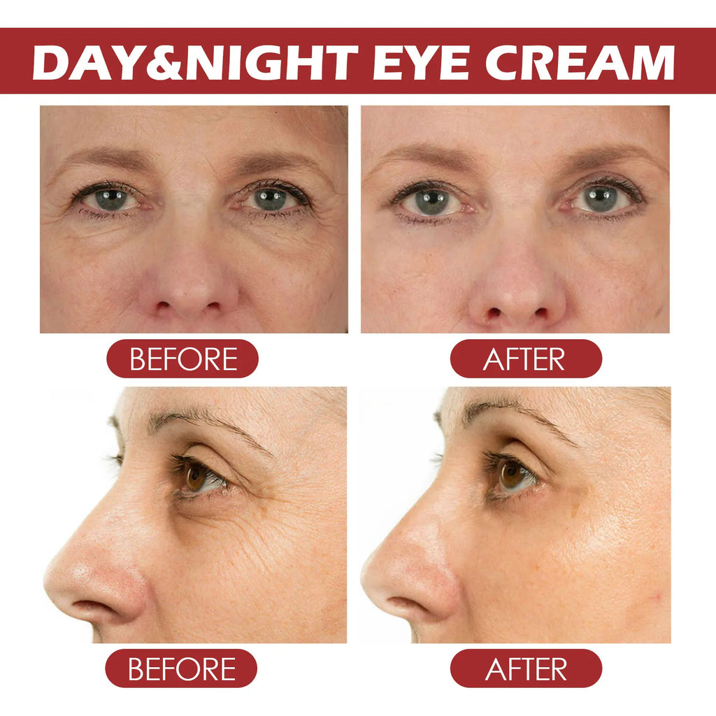 Eelhoe retinol olho vara 4g sob tratamento ocular círculo escuro redução de inchaço anti envelhecimento rolo linhas finas hidratante