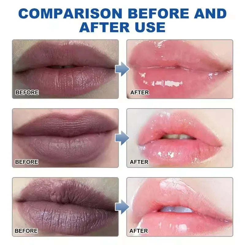 Remover bálsamo labial escuro, clareamento rápido, esfoliante labial rosa, linha labial, hidratante de pele morta, produtos de cuidados coreanos, beleza e saúde