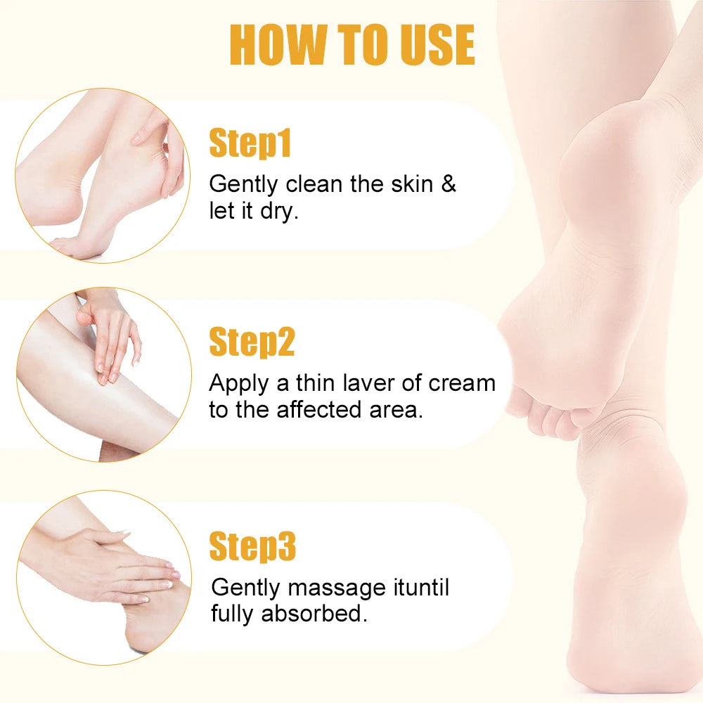 Creme Ultra-Hidratante para Pés com 60% de Ureia, Suaviza Pés Secos e Rachados, Exfoliação Suave, Creme Hidratante para Cuidados com os Pés