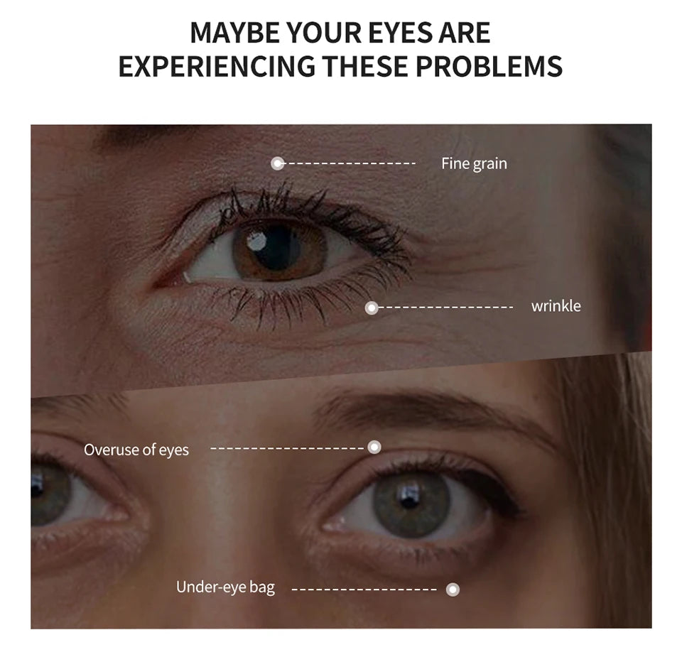 Instant apertar rugas creme para os olhos remover sacos de gordura dos olhos inchaço levantamento endurecimento suave nutrir cuidados com a pele dos olhos creme de massagem