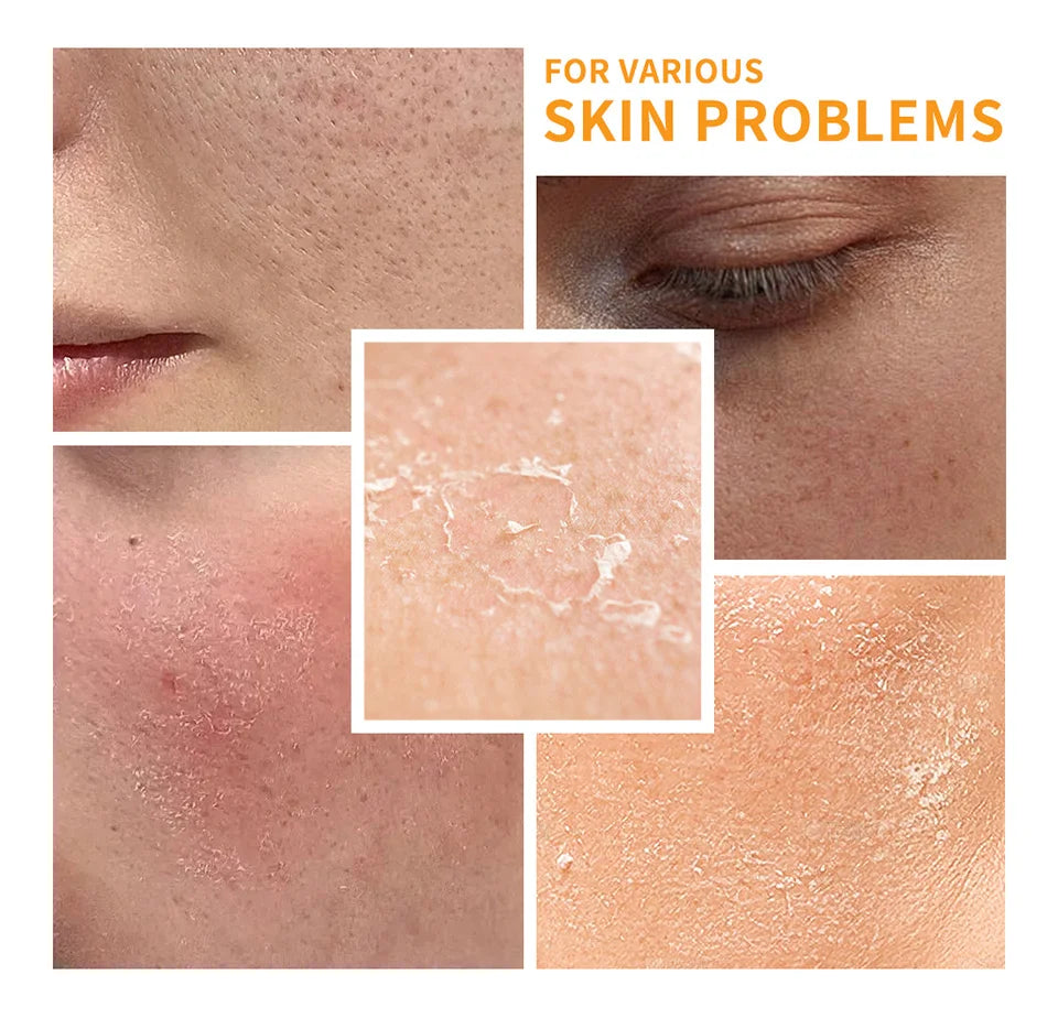 Lakerain vitamina c conjunto de cuidados com a pele 6 pçs kit creme de clareamento manchas escuras soro círculo escuro olho hidratante facial kits de clareamento