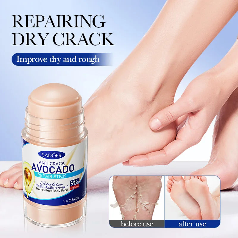 Creme para os pés, essência de pêssego, suaviza o calcanhar, hidratante, nutre o calcanhar, cuidados com os pés das mãos, creme para secura do calcanhar