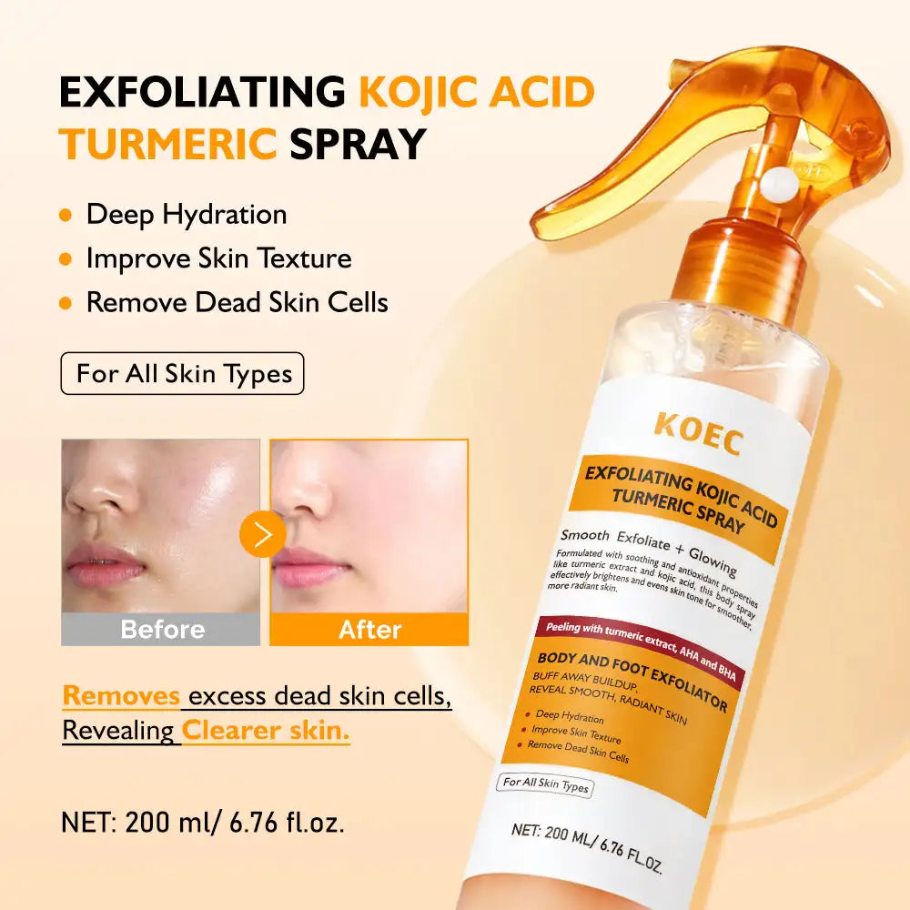 200ml Spray Esfoliante KOEC com Ácido Kójico e Cúrcuma Suaviza, Ilumina, Hidrata, Remove Células Mortas, Melhora a Textura da Pele e Limpa os Poros.