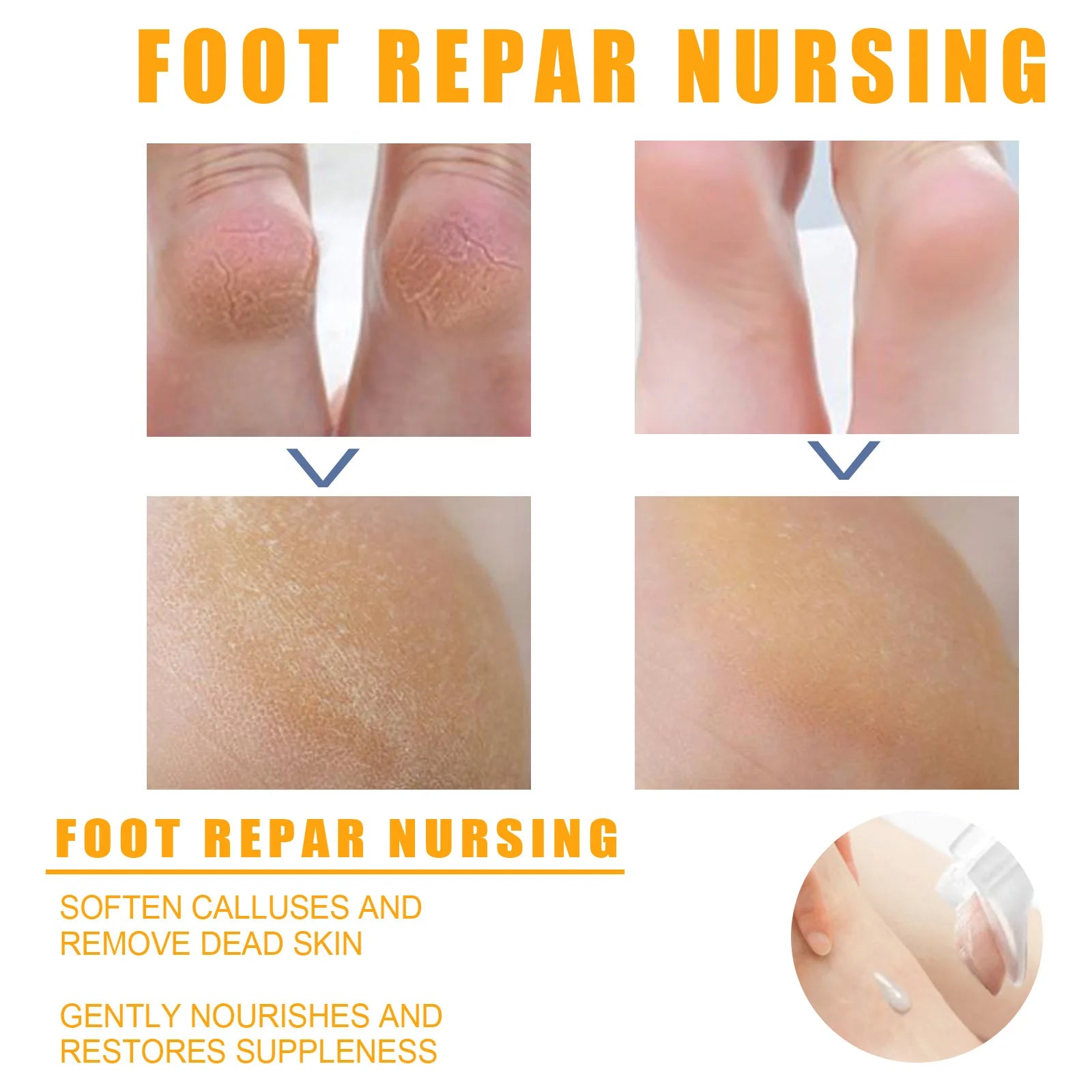 Creme anti-rachadura para pés, spray de ervas para rachaduras no calcanhar, produtos de reparo, esfoliação, remoção de pele morta, suavização, hidratação, cuidados suaves