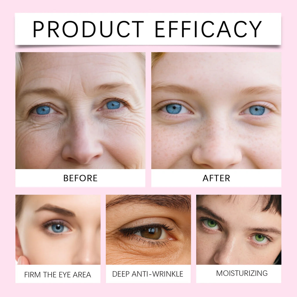 Adesivos de colágeno para os olhos, hidrogel, anti-ocírculos escuros, reduz o inchaço, levantamento instantâneo, nutritivo, antirrugas sob a máscara dos olhos