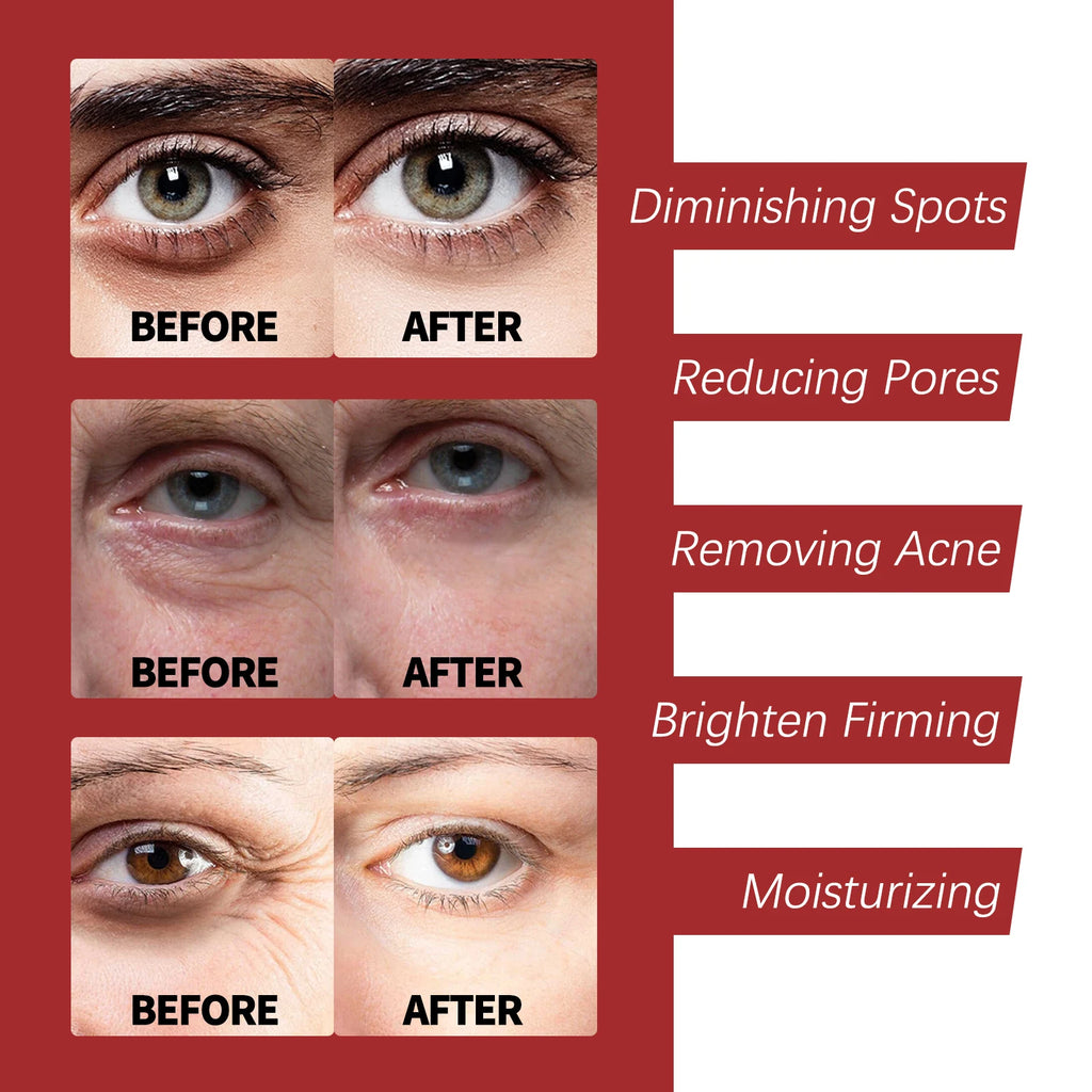 Retinol colágeno creme facial complexo dia noite creme ácido hialurônico reduzir linhas finas olheiras hidratar poros firmes