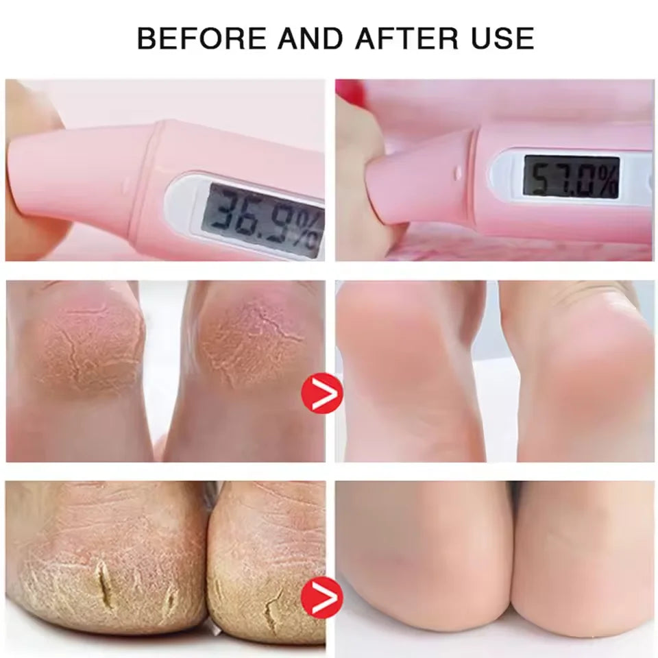 Creme anti-rachadura para pés, spray de ervas para rachaduras no calcanhar, produtos de reparo, esfoliação, remoção de pele morta, suavização, hidratação, cuidados suaves