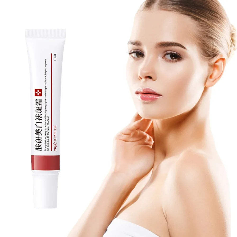 Poderoso creme de sardas para clarear o rosto, elimina manchas escuras do rosto, melasma, melanina, pigmentação, hidratar, creme de cuidados com a pele