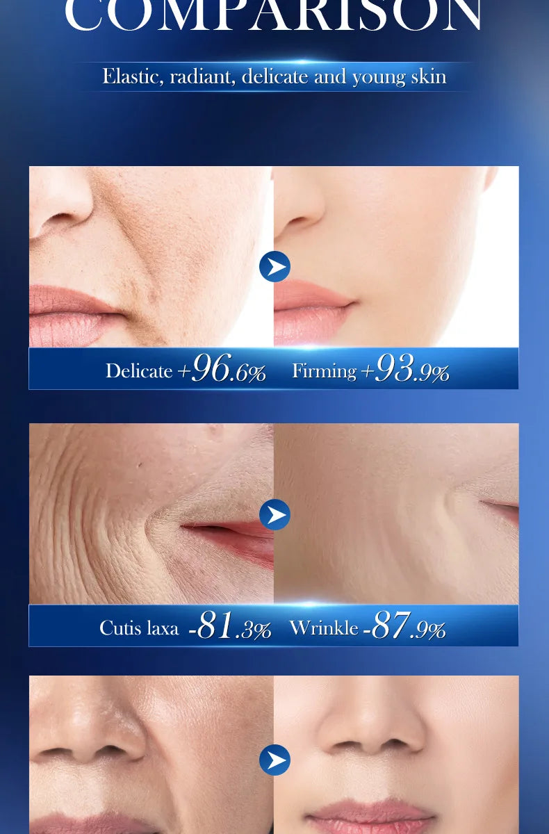 Remoção instantânea de rugas creme retinol rosto anti-envelhecimento endurecimento levantamento desbotamento linhas finas melhorar a pele hidratar iluminar cuidados com a pele