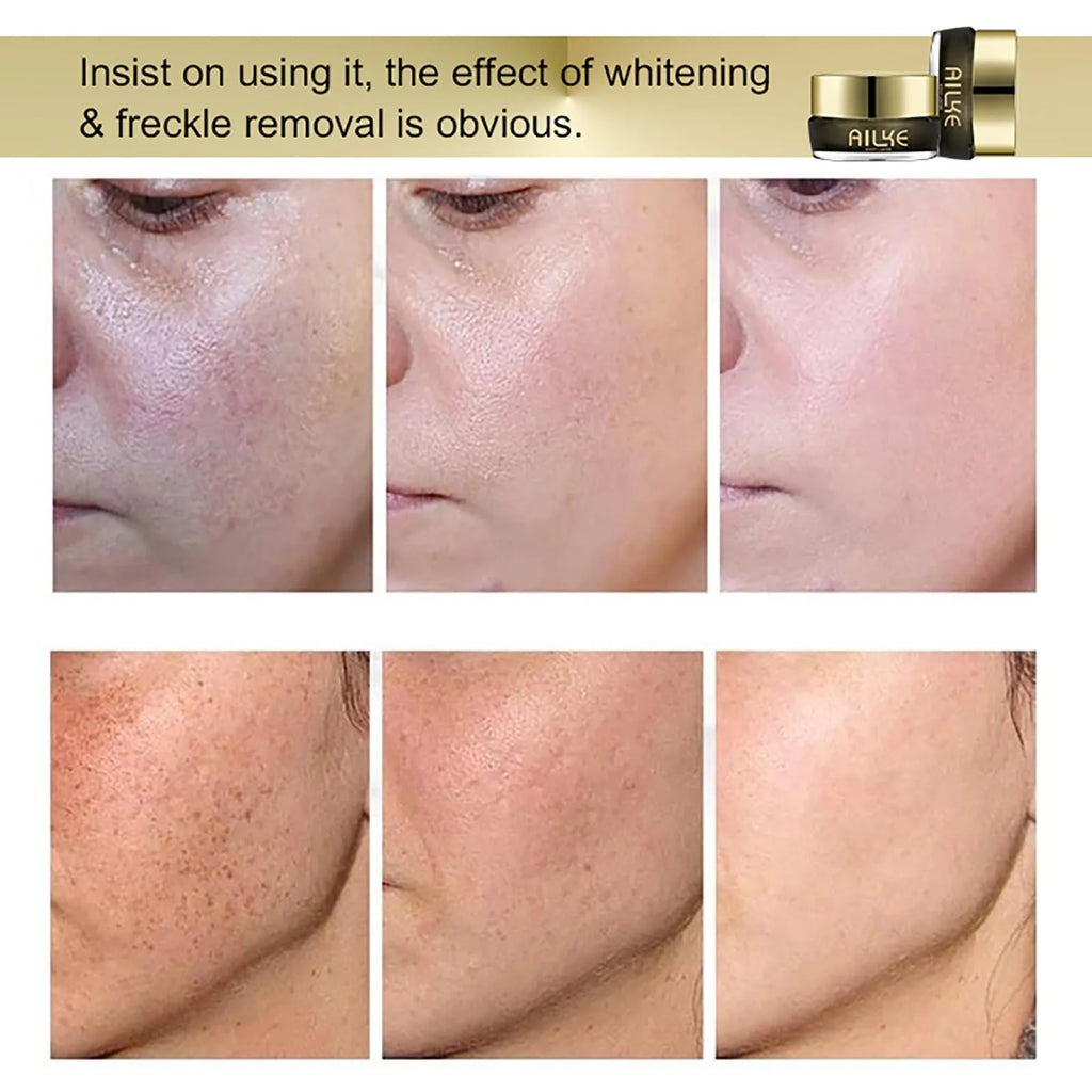 Creme facial clareador AILKE, reduz manchas escuras, rugas, melanina, mesmo tom de pele, com colágeno, glutationa, para todos os tipos de pele