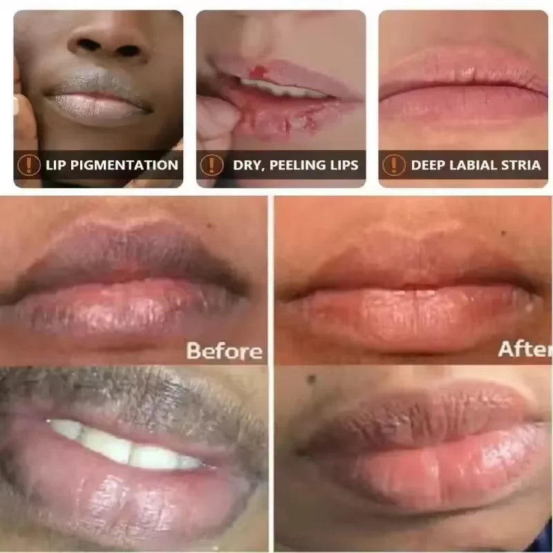Remover bálsamo labial escuro, clareamento rápido, esfoliante labial rosa, linha labial, hidratante de pele morta, produtos de cuidados coreanos, beleza e saúde