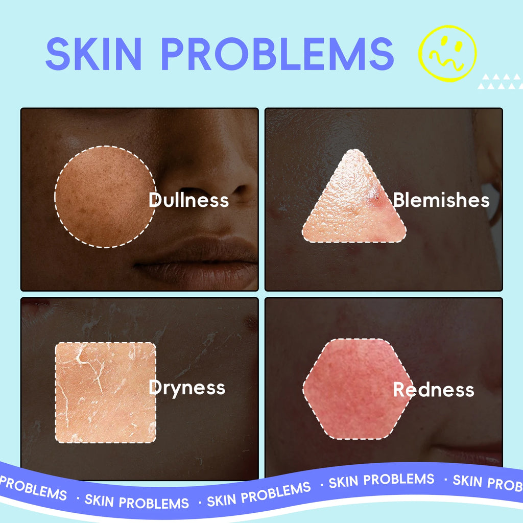 QUIYUM Fruit Fresh Collection Conjunto de cuidados com a pele de 5 peças, brilho, hidratante, anti-idade, cuidados faciais para pele seca e maçante