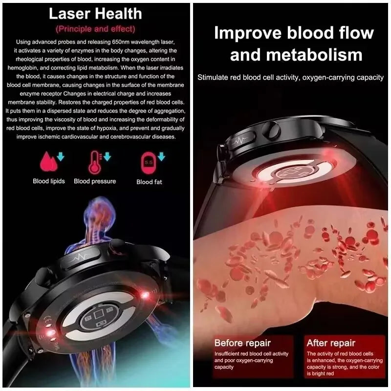 2025 novo tratamento a laser corpo e coração relógio inteligente masculino ecg + ppg ácido úrico gordura no sangue bluetooth chamada rastreador de saúde relógios inteligentes