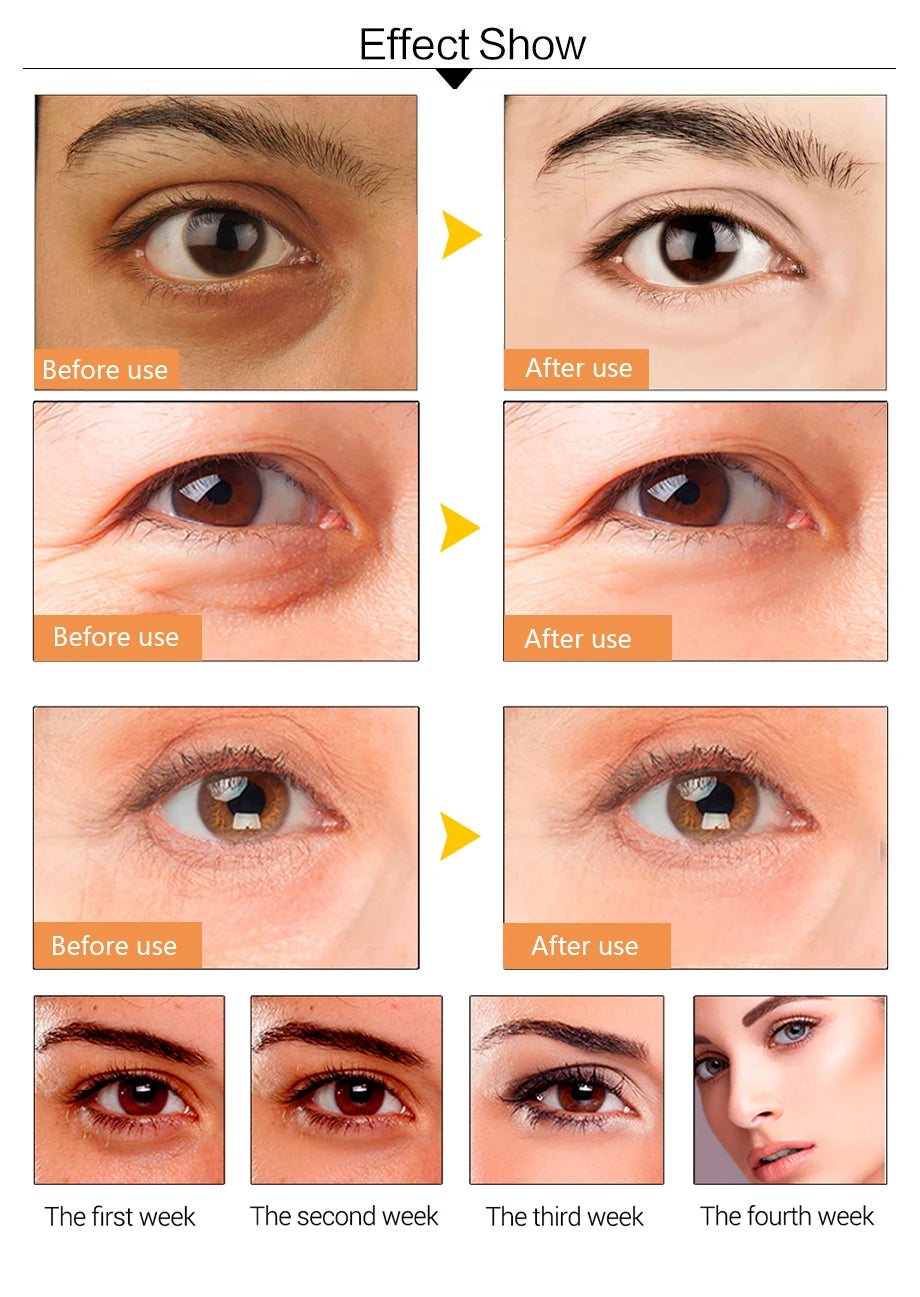 100 pçs = 50 pares máscara de olho de colágeno de ouro cuidados com a pele anti-envelhecimento anti olheiras remover inchaço hidratante remendos de olho cuidados com a pele