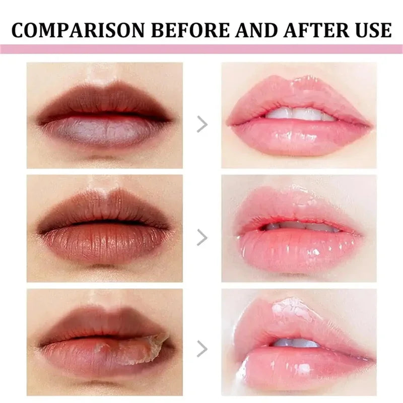 Remover bálsamo labial escuro, clareamento rápido, esfoliante labial rosa, linha labial, hidratante de pele morta, produtos de cuidados coreanos, beleza e saúde