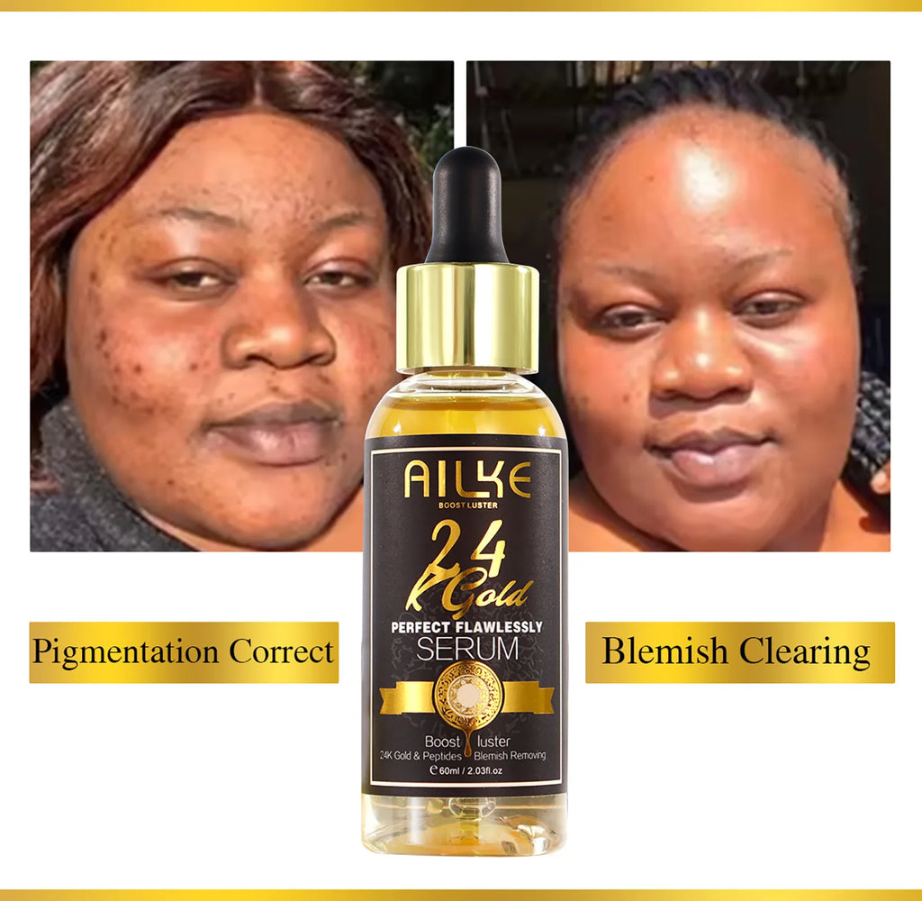 AILKE 24K Glod Alcance de cuidados com a pele impecável, clareador de pele, reduz manchas escuras, melanina, rugas, hidratação, para mulheres e homens