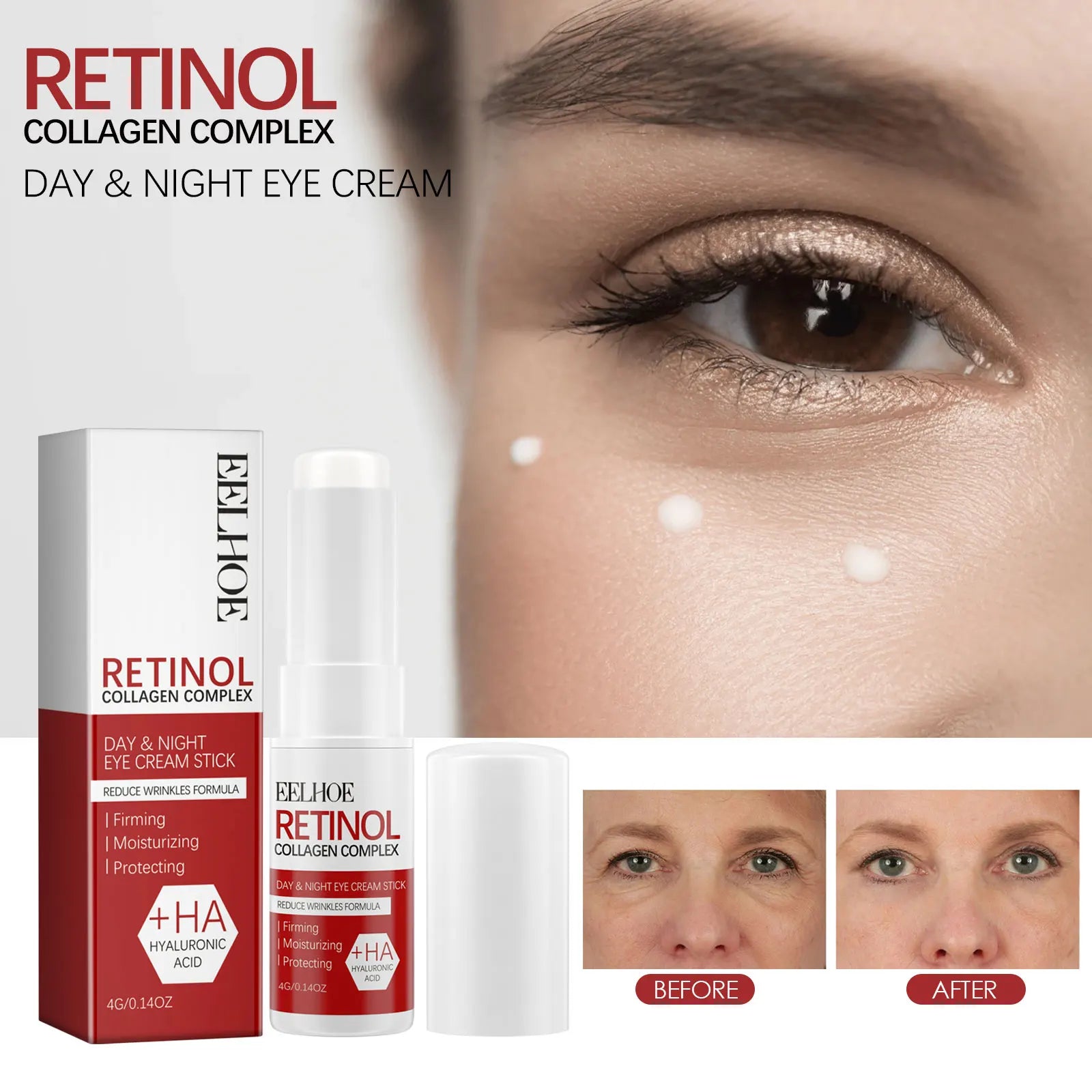 Eelhoe retinol olho vara 4g sob tratamento ocular círculo escuro redução de inchaço anti envelhecimento rolo linhas finas hidratante
