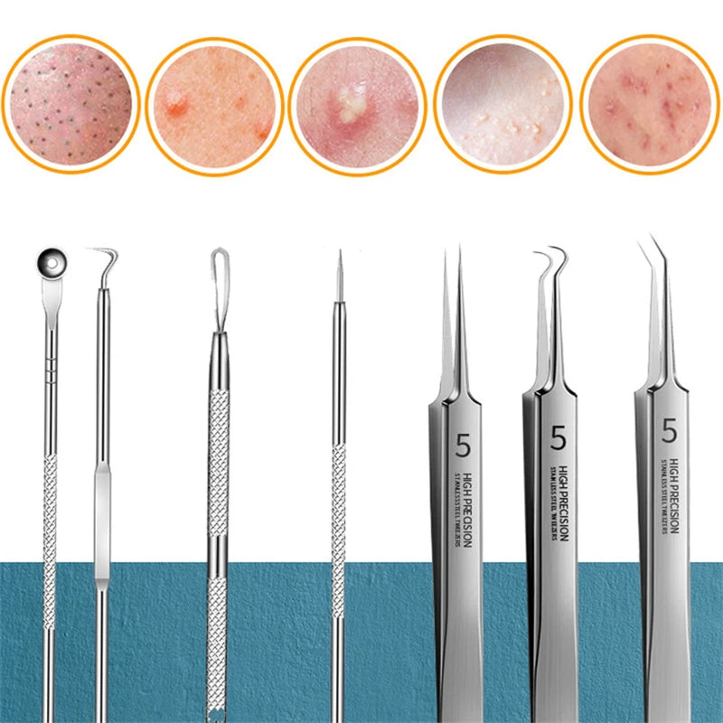 Removedor De Cravos Para Cuidados Com A Pele, Agulha De Acne, Extração De Poros, Black Head Cleaner, Ferramenta De Limpeza, Cell Clamp, 11 Pçs/conjunto