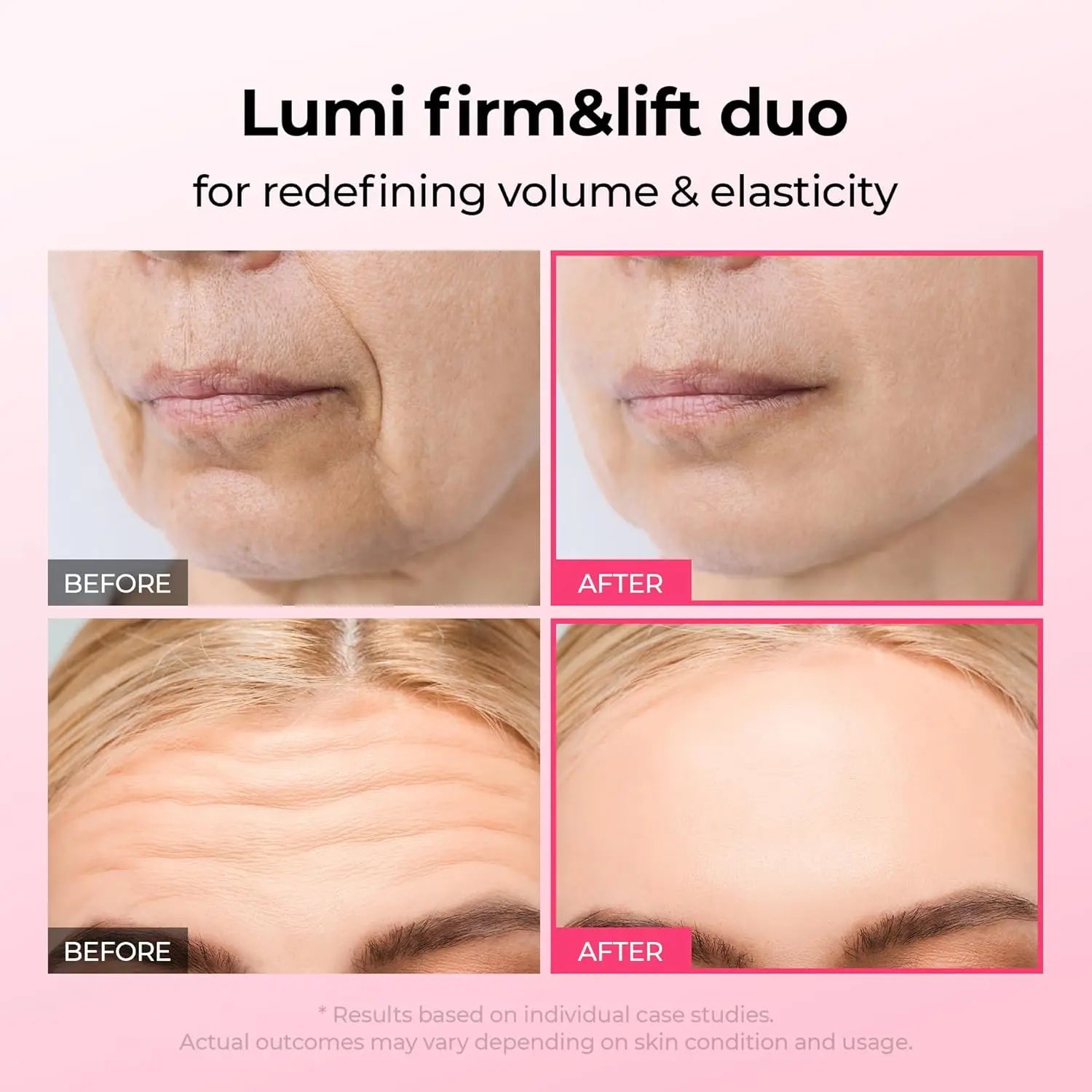 Dr.Melaxin Lumi Firm & Lift Duo |   Sérum coreano de colágeno para o rosto, que firma, preenche e refina a pele, aumentando a densidade e a reparação da pele.