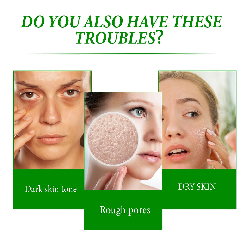 Retinol hidratante creme facial, iluminar, melanina, maçante Poro, encolhendo, hidratante, suave, escuro S-Pot removedor, loção